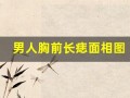 男人胸前长痣面相图(男人胸前长痣看相图解)